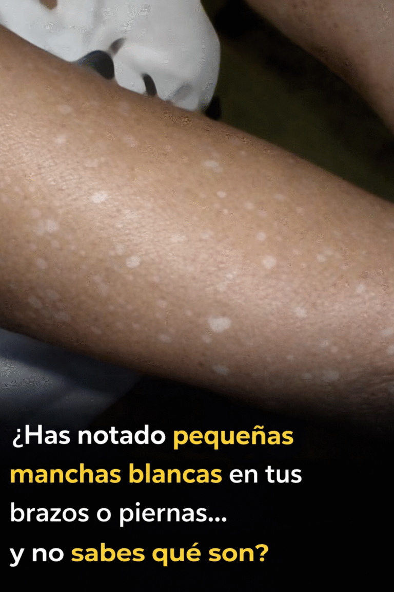 Pequeñas manchas blancas en brazos y piernas: lo que necesitas saber
