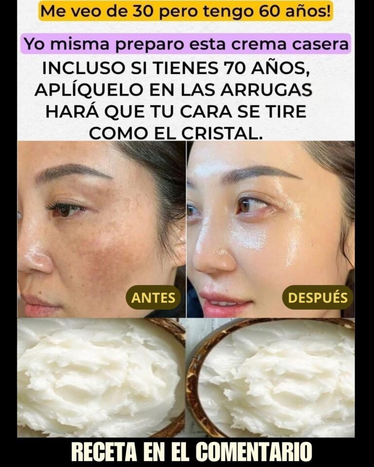 \,Prepara la crema de bicarbonato, ponla antes de dormir. Adiós arrugas y manc..ver mas. Para seguir recibiendo mis recetas, solo debes decir algo… ¡Gracias!