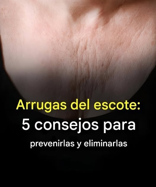Arrugas del escote: 5 consejos para prevenirlas y eliminarlas