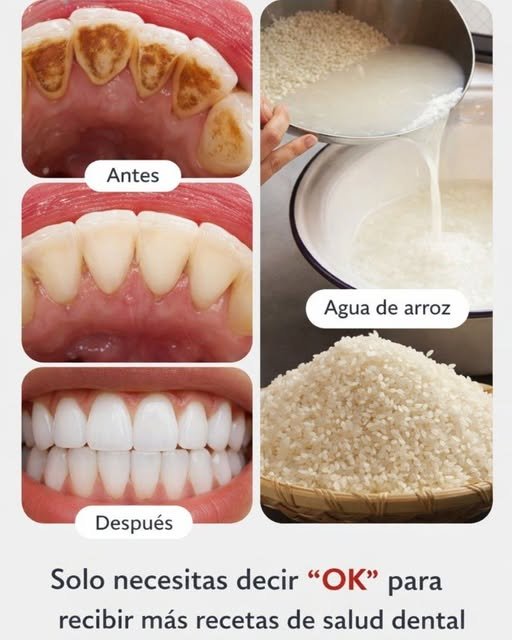 El secreto que tu dentista no quiere que sepas: elimina el sarro y blanquea tus dientes en solo 2 minutos.