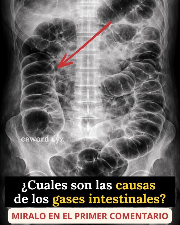 Tienes muchos gases y nadie te lo explica bien…
