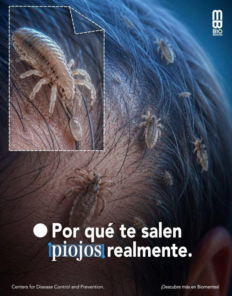 Piojos en los niñosPiojos en los niños