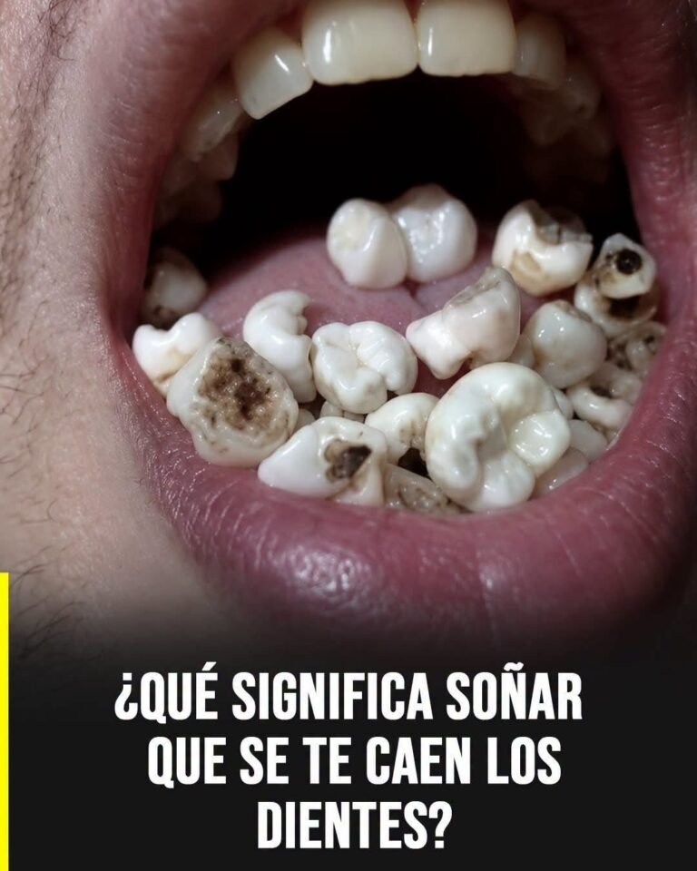 ¿Sabes qué significa soñar que se te caen los dientes? Descúbrelo en el 1er comentario