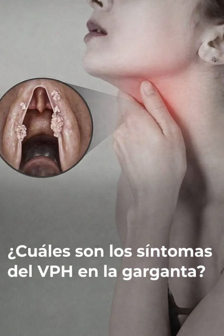 ¿Cuáles son los síntomas del VPH en la garganta? ….ver mas