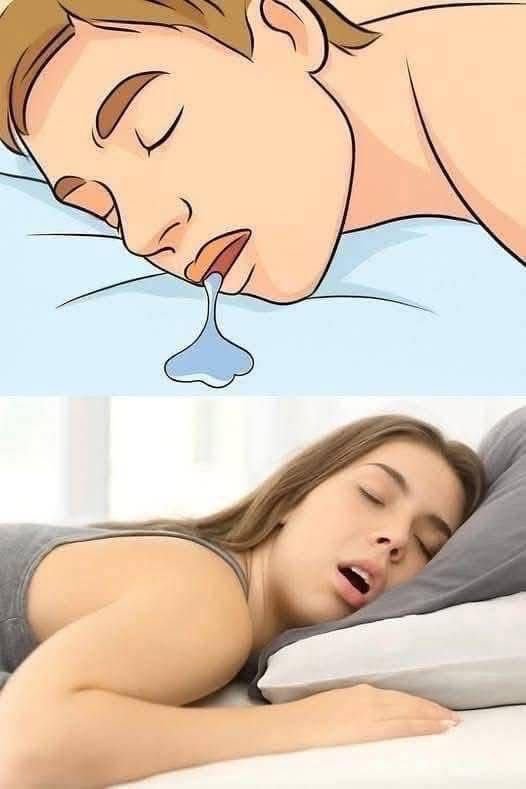¿Babeas al Dormir? Descubre el Misterio de la Almohada Mojada